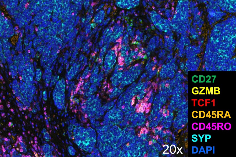 Multiplexe Färbungen in T-Zellen