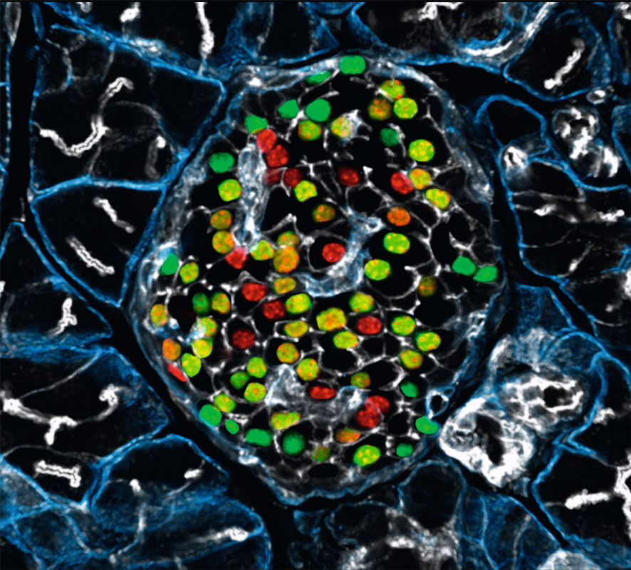 Die Betazellen der Bauchspeicheldrüse sind nicht alle gleich: Während Zellen, die das Molekül Flattop aufweisen (grün), sich um die Insulinproduktion kümmern, bilden Zellen ohne Flattop (rot) einen teilungsfähigen Reservepool.