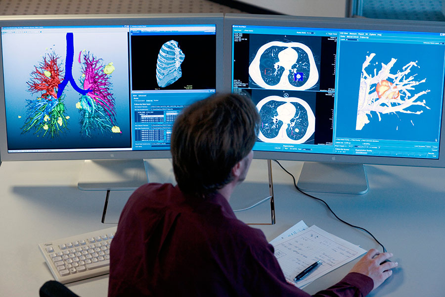 Computerunterstützte Analyse der Lunge basierend auf CT-Bilddaten