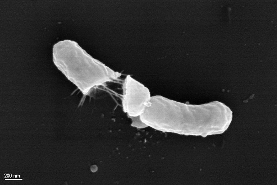 Elektronenmikroskopische Aufnahme einer geplatzten Bakterienzelle nach zweiminütiger Einwirkzeit des Wirkstoffs. Foto: Hyglos GmbH, Bernried
