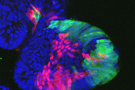 Konfokales Mikroskopiebild von Zellen in humanen Darm­Organoiden