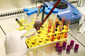 Mit einem neuartigen Testverfahren messen die Forschenden die Reaktion menschlicher T-Zellen auf unterschiedliche Teile von SARS-CoV-2.