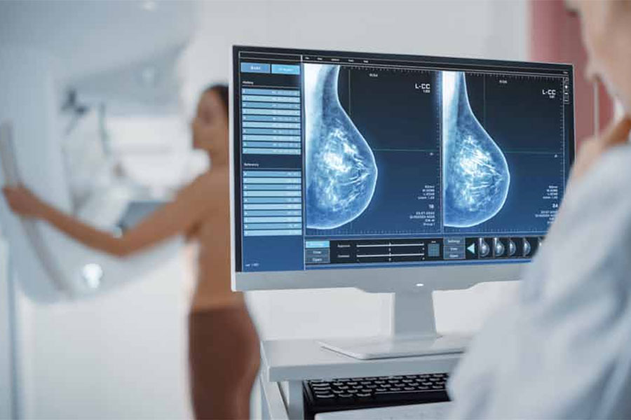 Mammografie-Untersuchung in ärztlicher Praxis