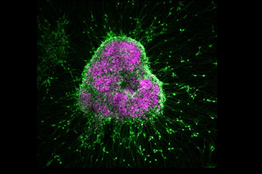 Hirnorganoide, die in vitro aus menschlichen induzierten pluripotenten Stammzellen gewonnen wurden (grün: neuronaler Marker MAP2; violett: neuraler Vorläufer-Marker SOX2)