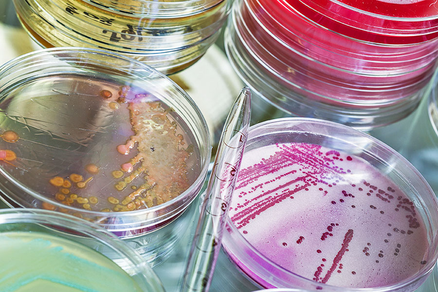 Testen von Bakterien und Bazillen in Petrischalen