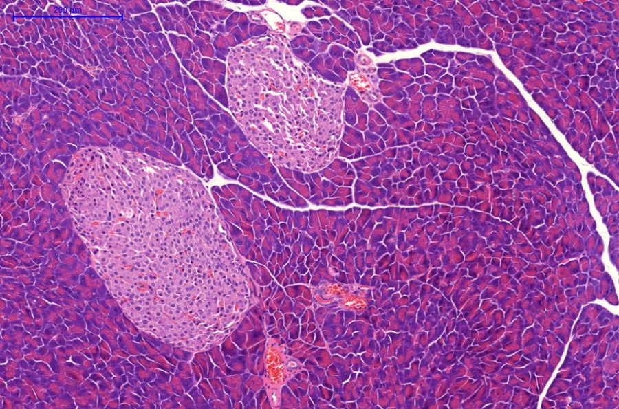Lichtmikroskopische Aufnahme der Bauchspeicheldrüse einer gesunden Maus. Die insulinproduzierenden Zellen in den sogenannten Langerhans-Inseln sind hellrosa gefärbt. Fettzellen sind nicht erkennbar.