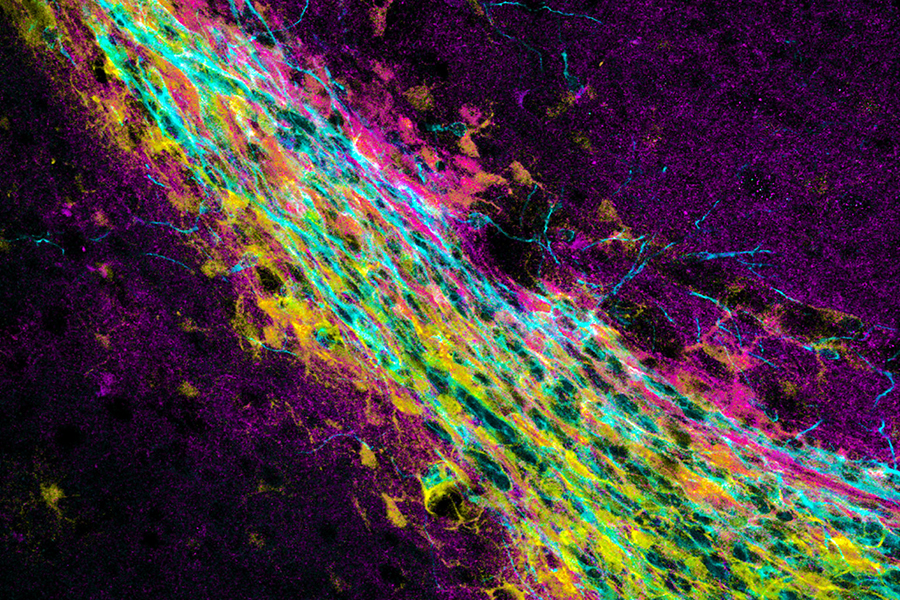 Mikroskopische Aufnahme von verschiedenen Zelltypen. Neuronale Stammzellen sind cyan gefärbt
