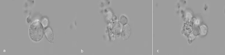 Die UniCAR­T­Zellen docken an die größere Tumorzelle in der Bildmitte an (a). Sie aktivieren ihren Zerstörungsmechanismus und töten die Zielzelle, die in immer kleinere Fragmente zerfällt (b, c).