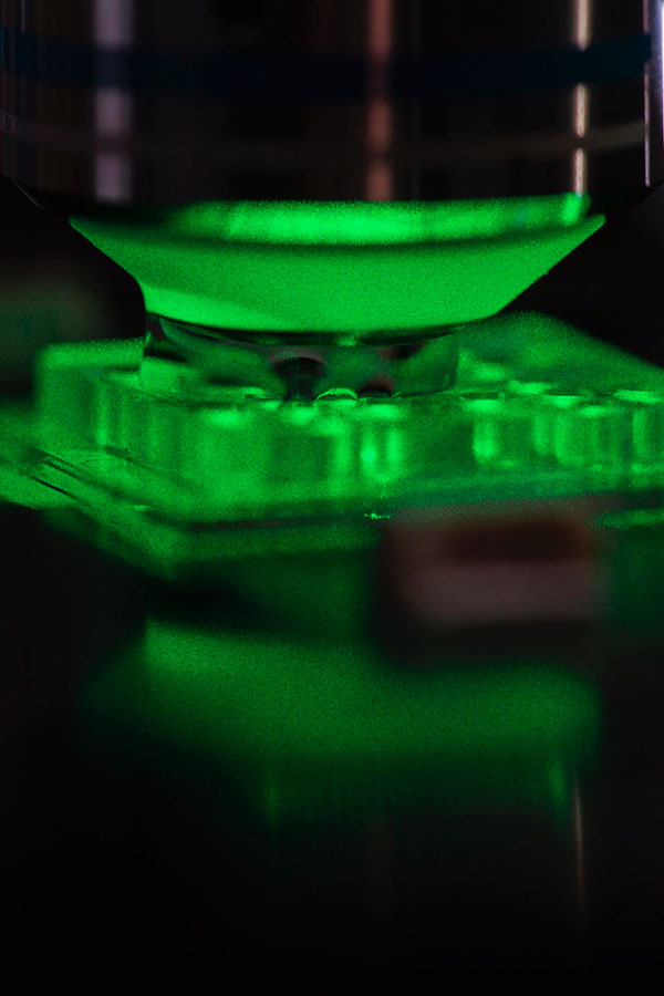 Eine Bakterienprobe (z. B. aus einer Patientenurinprobe) wird im Raman-Mikrofluidik-Chip mit grünem Laserlicht unter einem Mikroskop bestrahlt. 