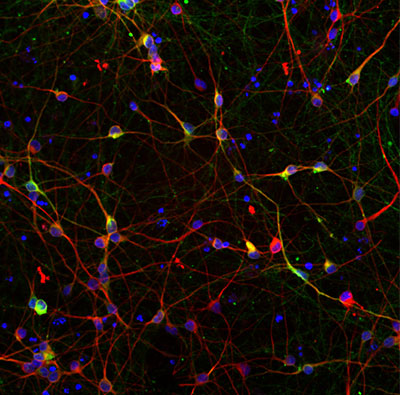 Auf dem Mikroskopie­Bild sind in Rot Neuronen und in Blau Zellkerne zu erkennen. Die Überlagerung mit Grün zeigt Dopamin erzeugende Neuronen an. Dieser Zelltyp ist maßgeblich von Parkinson betroffen.