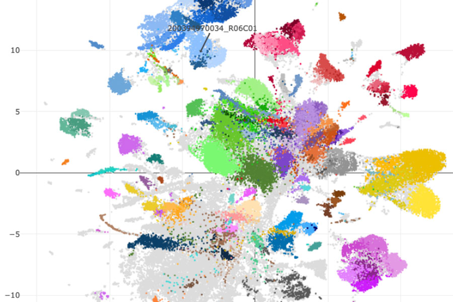 Die unterschiedlichen Farben zeigen die molekularen Fingerabdrücke von fast 100.000 Hirntumorproben.