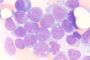 Blutzellen mit weißen Blutkörperchen