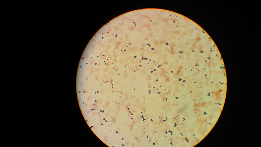 Ein Blick durch das Lichtmikroskop verrät, dass diese Blutprobe Staphylococcus aureus (kleine dunkle Punkte) enthält.