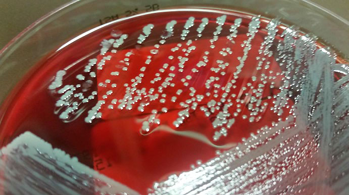 So sehen Staphylococcus aureus Bakterien-Kolonien aus. Im Labor werden die Bakterien auf speziellen Nährböden gezüchtet.
