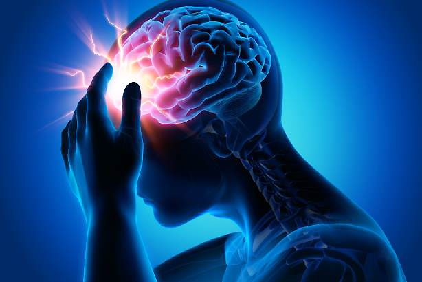 Kopfschmerz ist nicht gleich Kopfschmerz: So vielfältig die Ursachen der Schmerzen sein können, so unterschiedlich stark können sie auftreten. Der Cluster-Kopfschmerz gehört zu den besonders schwerwiegenden Formen des Kopfschmerzes.