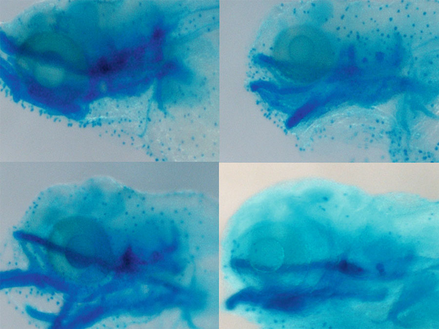 Die Bilder zeigen mikroskopische Aufnahmen von Zebrafisch-Köpfen. Das Bild oben links zeigt einen gesunden Fisch. Unten links und auf der rechten Seite sind Bilder von Zebrafischen, bei denen verschiedene Kabuki- Gene verändert wurden. Auffällig sind die Veränderungen des Schädelskeletts in dunkelblauer Farbe.