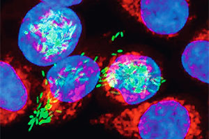 Grün eingefärbte Salmonellen dringen in die rotblau gefärbten menschlichen Zellen ein.