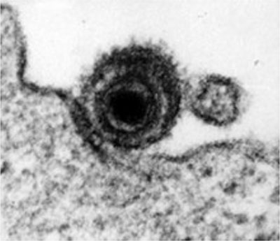 Das elektronenmikroskopische Bild zeigt das Epstein-Barr-Virus. Der typische Aufbau des 170 μm großen Virus besteht aus Virushülle, Tegument und Capsid, welches die DNA umschließt (von außen nach innen).