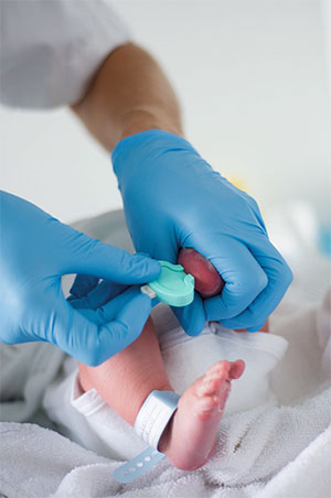 Beim Neugeborenen-Screening werden ein paar Blutstropfen entnommen und anschließend im Labor untersucht.