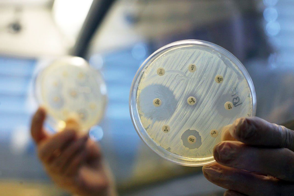 Bakterienkultur beim Test auf Antibiotika-Resistenz. 