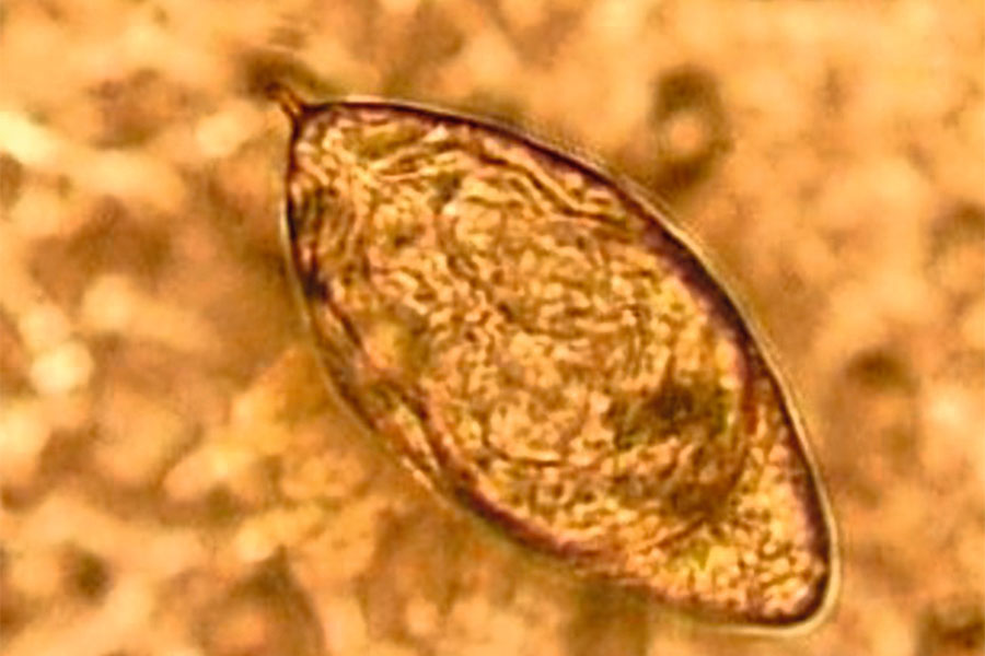 So sehen die Eier des Saugwurmes Schistosoma haematobium, Erreger der gefährlichen Infektionskrankheit Bilharziose (Schistosomiasis), unter dem Mikroskop aus.