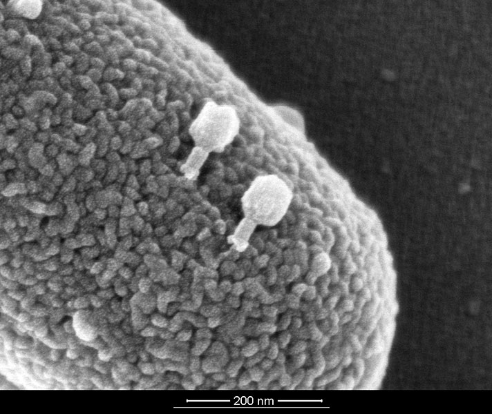 Elektronenmikroskopische Aufnahme von T4Bakteriophagen auf der Oberfläche eines Escherichia-coli- Bakteriums. Foto: Hyglos GmbH, Bernried