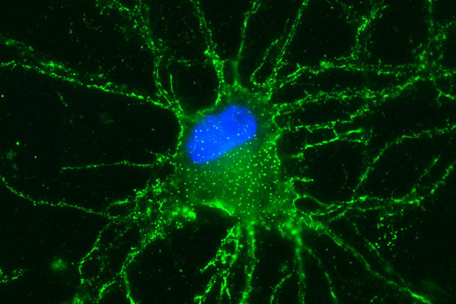 Dargestellt ist ein Neuron des Hippocampus eines Nagetiers, das in einer Zellkultur gezüchtet wurde. 