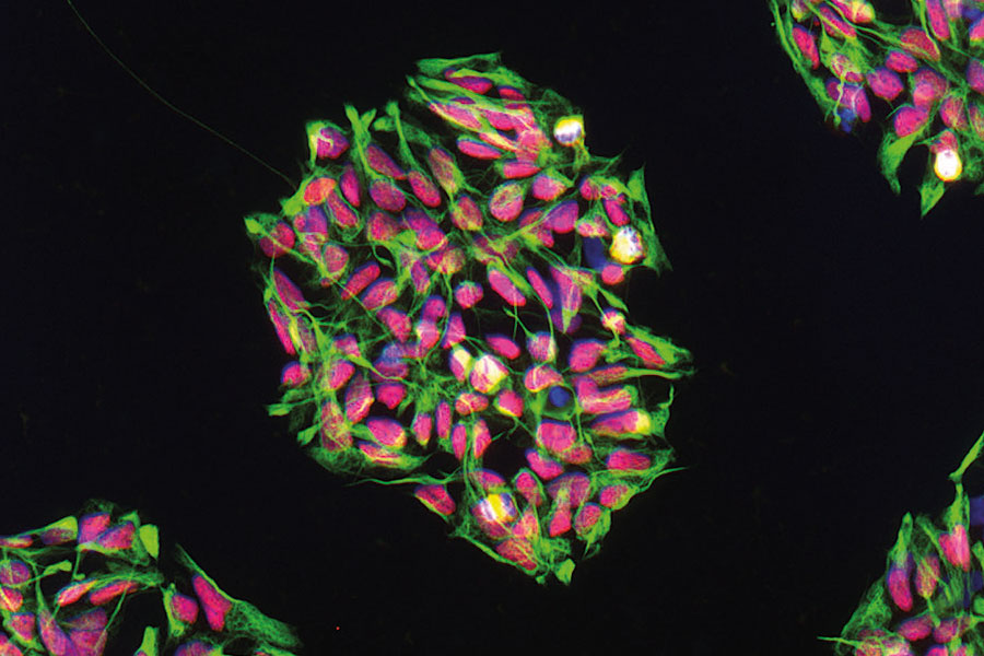 Fluoreszenzmikroskopische Aufnahme neuronaler Vorläuferzellen.