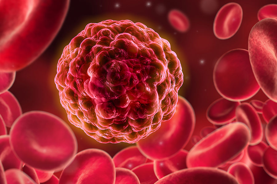 Krebszelle zwischen roten Blutkörperchen