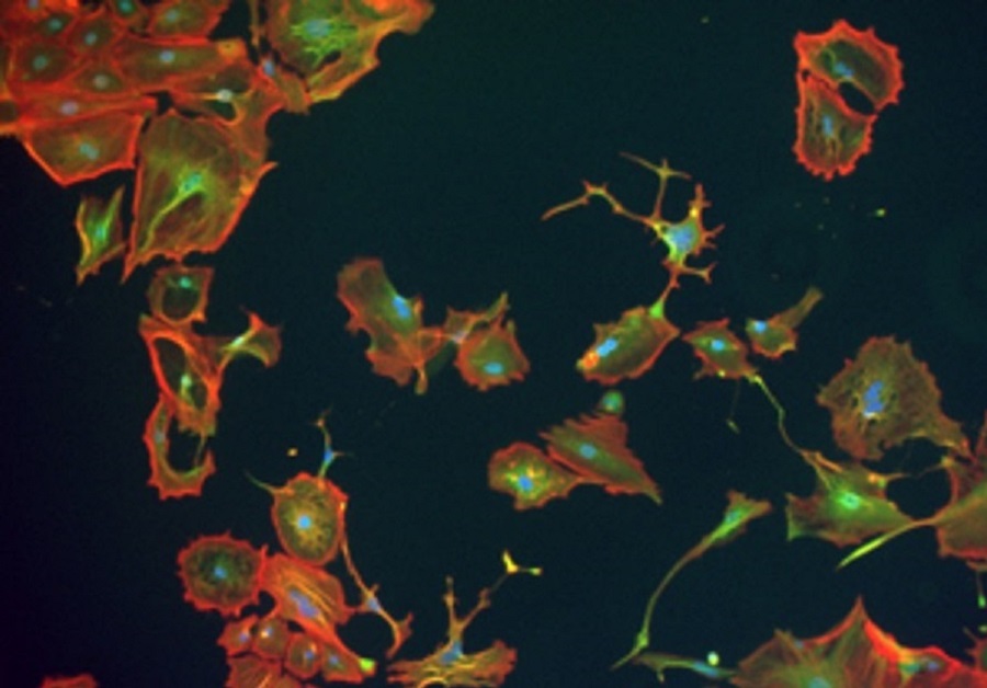 Im Labor kultivierte Zellen einer Sarkomkrebszelllinie. Die Forschenden können Zellbestandteile (Zellkern: blau, grün: ein Stoffwechselenzym, rot: ein Strukturprotein) anfärben und damit sichtbar machen.