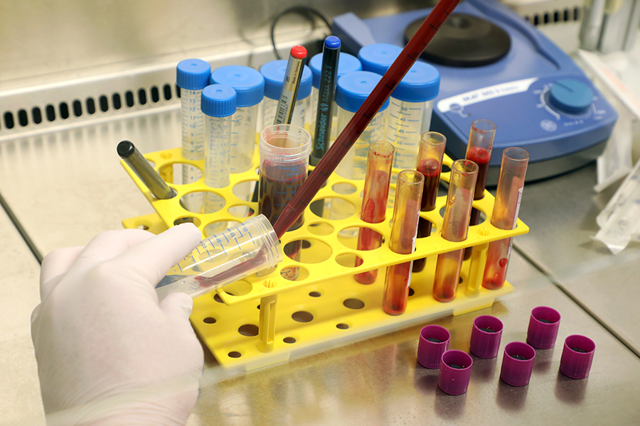 Reagenzgläser mit Blutproben im Labor werden untersucht