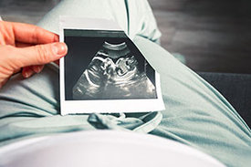 Junge Frau hält Ultraschallbild des Babys in der Hand.