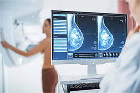 Mammografie-Untersuchung in ärztlicher Praxis