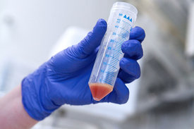 Blutprobe in einem Laborgefäß