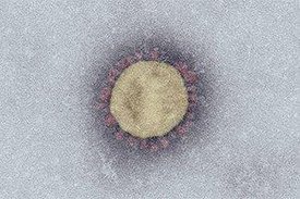 Das neue SARS-Coronavirus-2 unter dem Elektronenmikroskop (Maßstab: 100 nm). © Robert Koch-Institut 