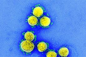 Forschungsobjekt mit höchster Priorität: SARS-Coronaviren