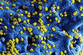 Coronaviruspartikel (gelb angefärbt) unter dem Elektronenmikroskop.