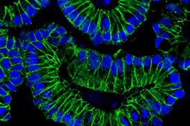 Darm-Organoide: Nach einer Behandlung mit IFN-Y differenzieren die Darmzellen. Die Zellkerne (blau) der Epithelzellen (grün) lokalisieren sich am basalen (äußeren) Rand der Organoide. 