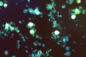 Mikroskopische Aufnahme von Zellkulturen