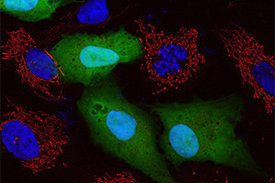 Fluoreszenzkonfokales Bild von kultivierten humanen Zellen. Zu sehen ist die Reaktivierung von HHV-6 (GFP-positive Zellen, grün), die den Verlust von Mitochondrien (rot) verursacht. Die Zellkerne sind blau gefärbt.