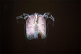 3D-Visualisierung der Lunge. < 3D-Visualisierung der Lunge.