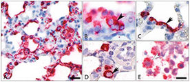 Einblick in infiziertes Lungengewebe: Schon am zweiten Tag befällt SARS-CoV-2, rot markiert, fast alle Bereiche der Lunge – auskleidende Zellen der Atemwege (B) wie auch Zellen der Lungenbläschen (C und D). Makrophagen (E).