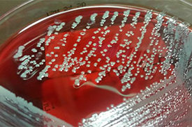 So sehen Staphylococcus aureus Bakterien-Kolonien aus. Im Labor werden die Bakterien auf speziellen Nährböden gezüchtet.