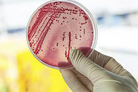 Viele der natürlich produzierten Antibiotika wurden noch gar nicht entdeckt, weil die Mikroorganismen, die sie produzieren, bislang nicht im Labor gezüchtet und untersucht werden konnten.