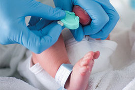 Beim Neugeborenen-Screening werden ein paar Blutstropfen des Babys entnommen und anschließend im Labor untersucht.