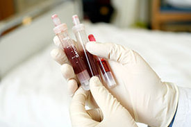 Medizinische Fachkraft mit Blutproben