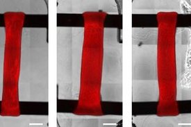 Drei rote Herzmuskelstreifen im Labor. Der des Patienten in der Mitte ist im Vergleich zu dem eines gesunden Spenders (links) deutlich verdickt. Diesen Effekt konnte der hier untersuchte Wirkstoff sichtbar reduzieren (rechts).
