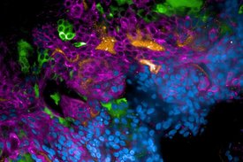 Fluoreszenzmikroskopische Aufnahme eines mit SARS-CoV-2-infizierten Lungengewebes