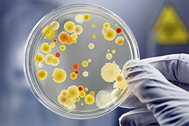 Petrischale mit Bakterien-Kultur. Selten war der Rat der Wissenschaft so wichtig wie jetzt.