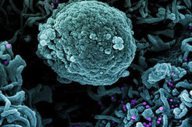 Eingefärbtes Rasterelektronenmikroskopbild einer Zelle (blaugrün), die mit einer Variante von SARS-CoV-2-Viruspartikeln (UK B.1.1.7; lila) infiziert ist, die aus einer Patientenprobe isoliert wurde. 